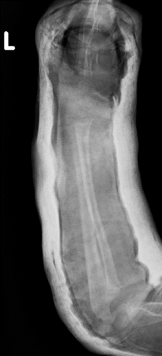Post-reduction X-rays 