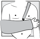 Broad arm sling