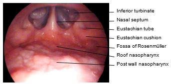 Figure 22