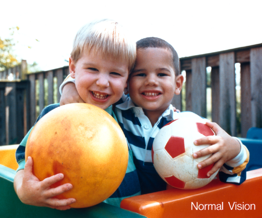 Image of Normal vision